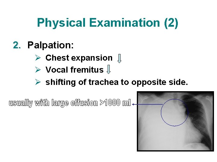 Physical Examination (2) 2. Palpation: Ø Chest expansion Ø Vocal fremitus Ø shifting of Physical Examination (2) 2. Palpation: Ø Chest expansion Ø Vocal fremitus Ø shifting of
