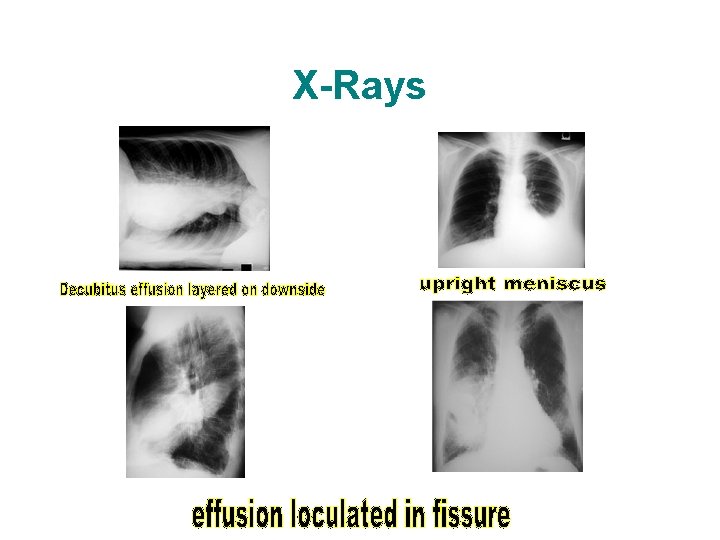 X-Rays X-Rays