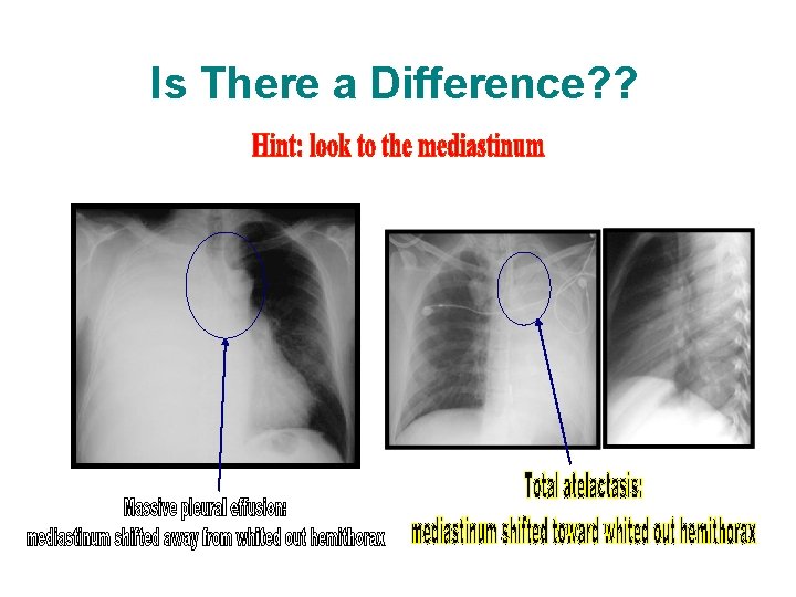 Is There a Difference? ? Is There a Difference? ?