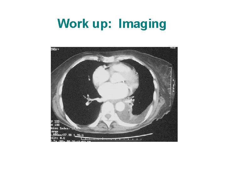 Work up: Imaging Work up: Imaging