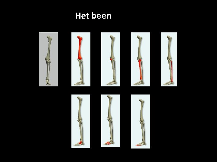 Het been dijbeen Voetwortelbeentjes knieschijf Middenvoetsbeentjes Scheenbeen teenkootjes kuitbeen 