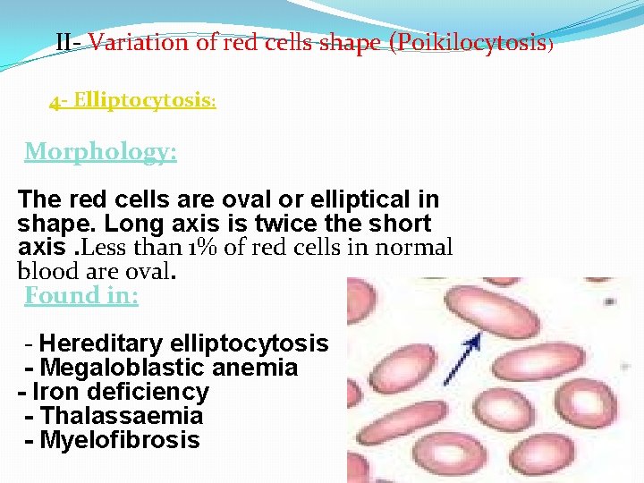 II- Variation of red cells shape (Poikilocytosis) 4 - Elliptocytosis: Morphology: The red cells