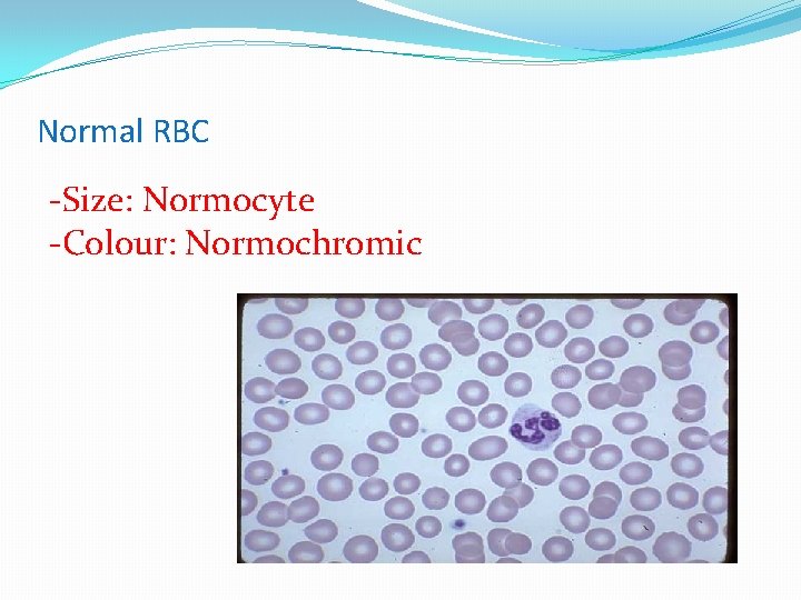 Normal RBC -Size: Normocyte -Colour: Normochromic 