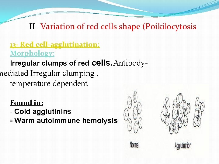 II- Variation of red cells shape (Poikilocytosis 13 - Red cell-agglutination: Morphology: Irregular clumps