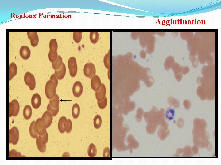 Rouloux Formation Agglutination 