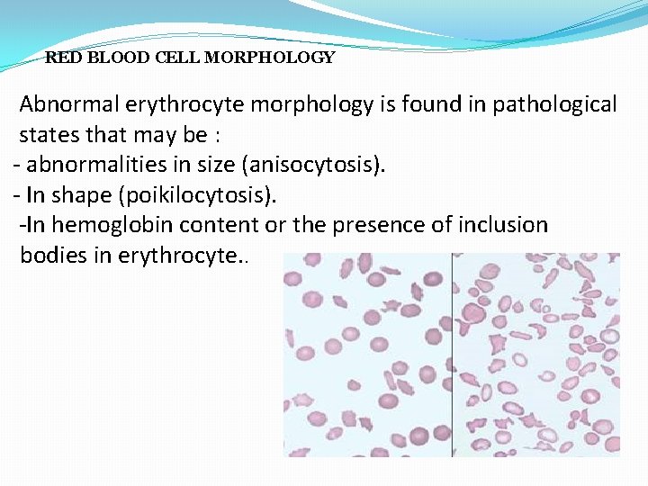 RED BLOOD CELL MORPHOLOGY Abnormal erythrocyte morphology is found in pathological states that may