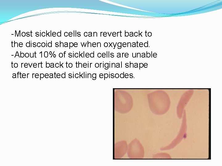 -Most sickled cells can revert back to the discoid shape when oxygenated. -About 10%