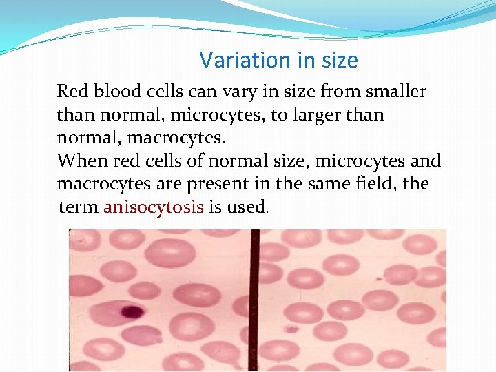 Variation in size Red blood cells can vary in size from smaller than normal,