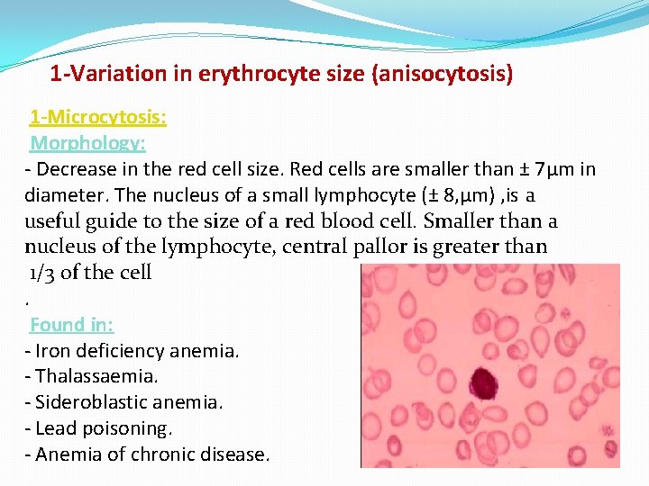 1 -Variation in erythrocyte size (anisocytosis) 1 -Microcytosis: Morphology: - Decrease in the red