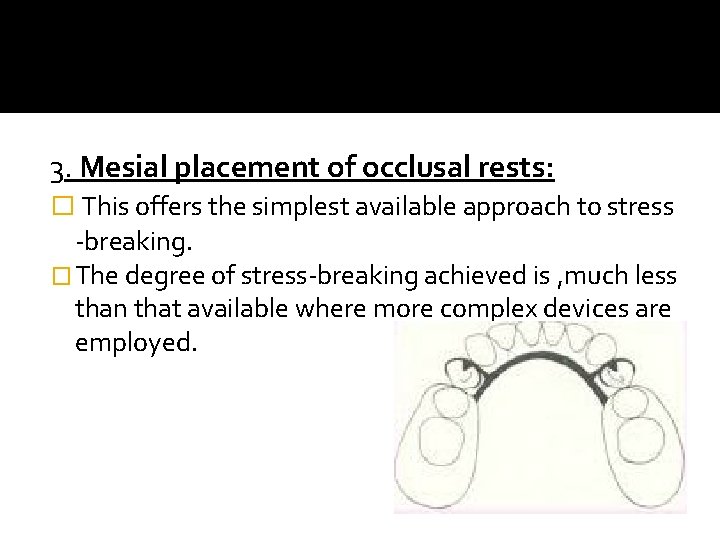 3. Mesial placement of occlusal rests: � This offers the simplest available approach to
