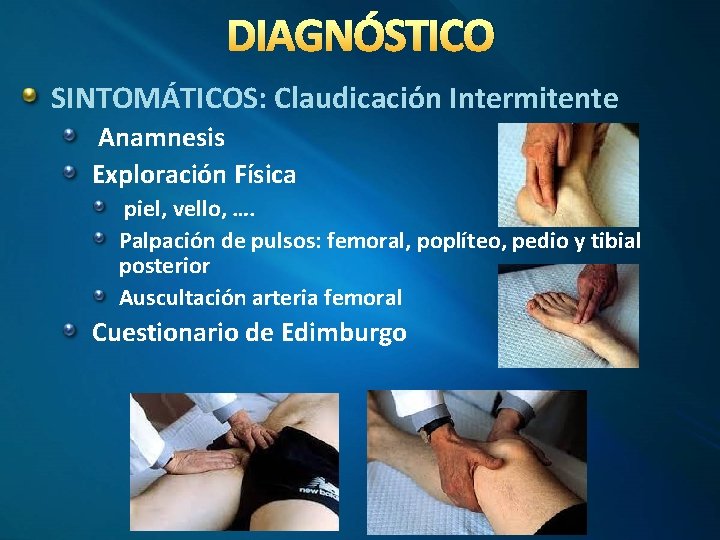 DIAGNÓSTICO SINTOMÁTICOS: Claudicación Intermitente Anamnesis Exploración Física piel, vello, …. Palpación de pulsos: femoral,