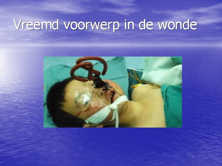 Vreemd voorwerp in de wonde 