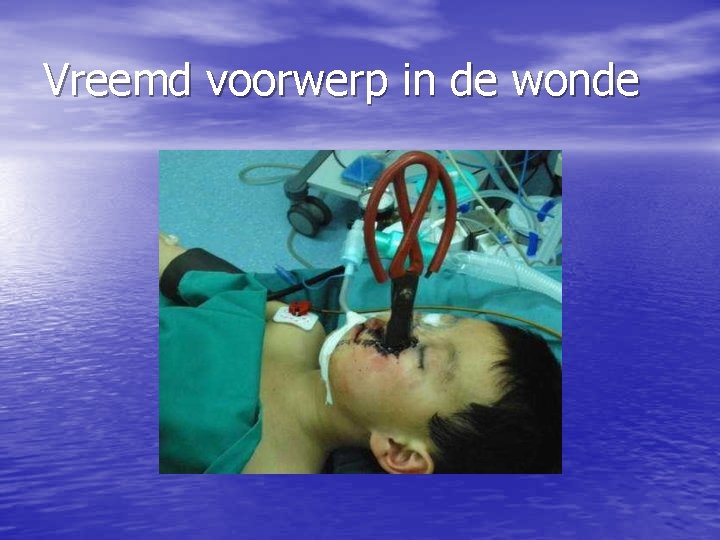 Vreemd voorwerp in de wonde 