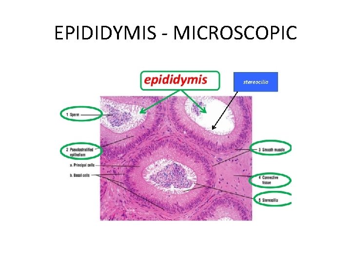 EPIDIDYMIS - MICROSCOPIC 