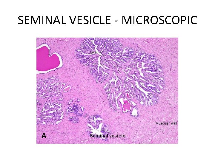 SEMINAL VESICLE - MICROSCOPIC 