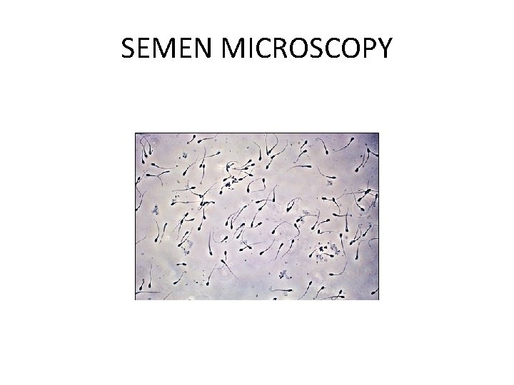 SEMEN MICROSCOPY 