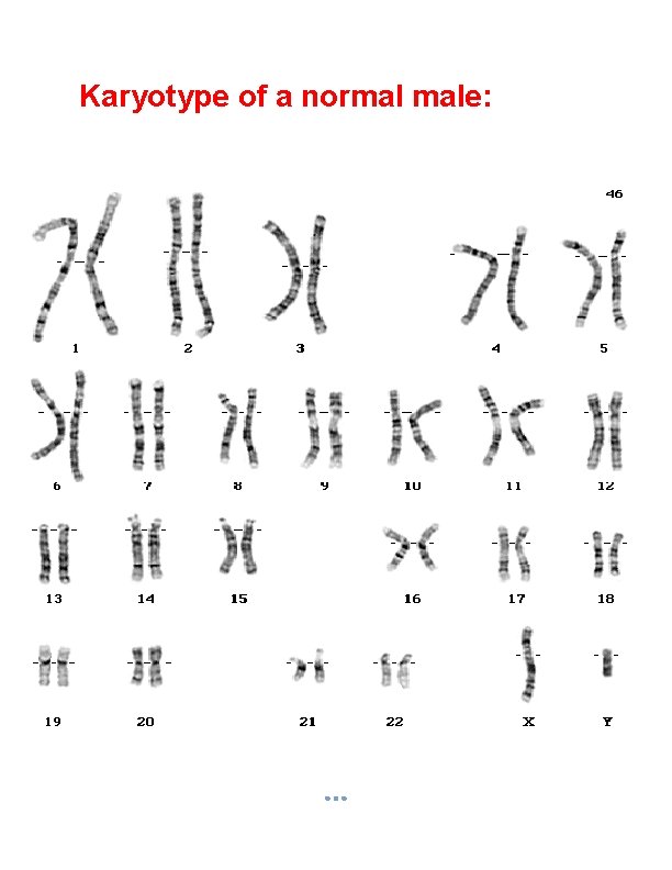 Karyotype of a normal male: 