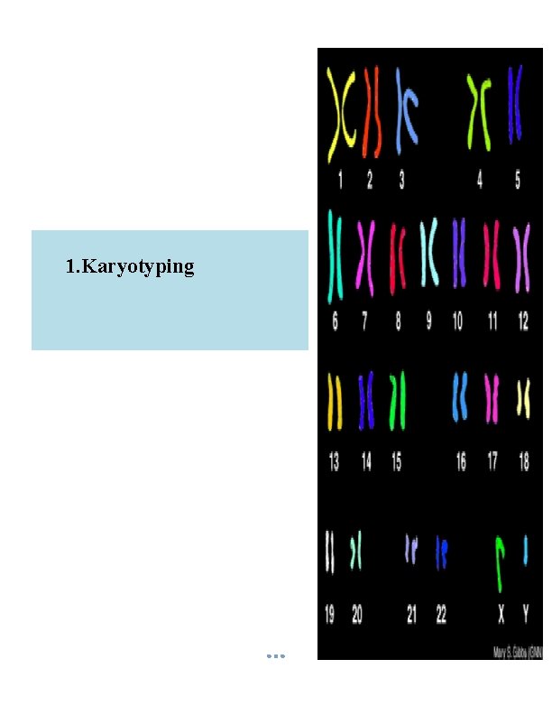 1. Karyotyping 