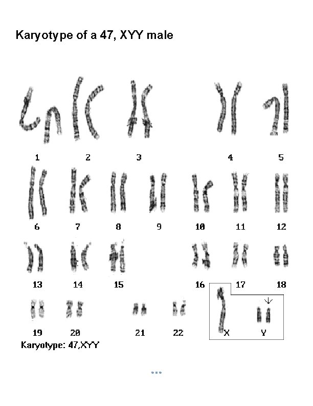 Karyotype of a 47, XYY male 
