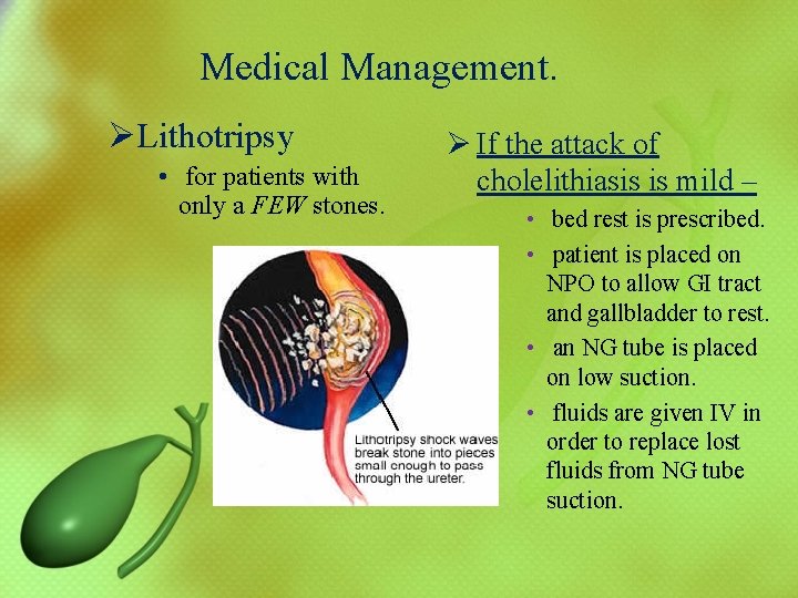 Medical Management. ØLithotripsy • for patients with only a FEW stones. Ø If the