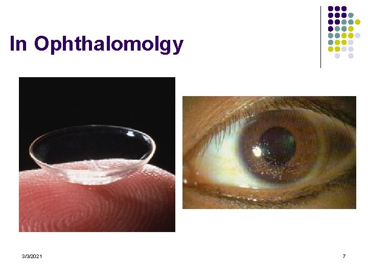 In Ophthalomolgy 3/3/2021 7 