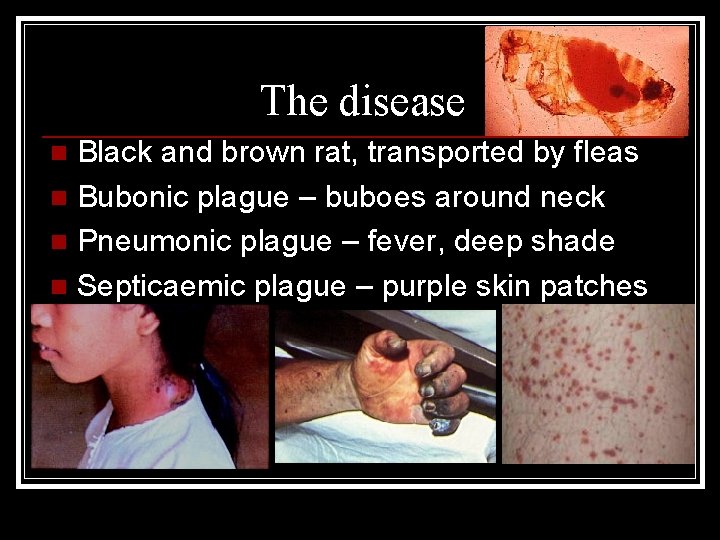 The disease Black and brown rat, transported by fleas n Bubonic plague – buboes