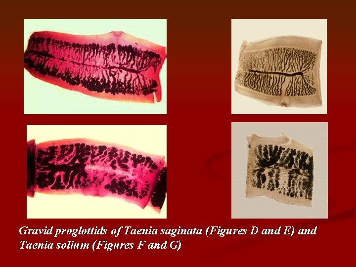 Gravid proglottids of Taenia saginata (Figures D and E) and Taenia solium (Figures F