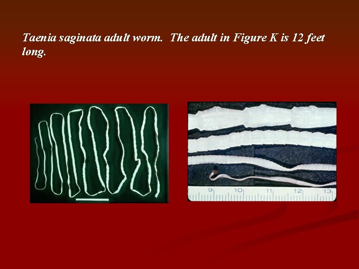 Taenia saginata adult worm. The adult in Figure K is 12 feet long. 