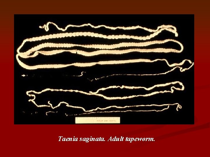 Taenia saginata. Adult tapeworm. 