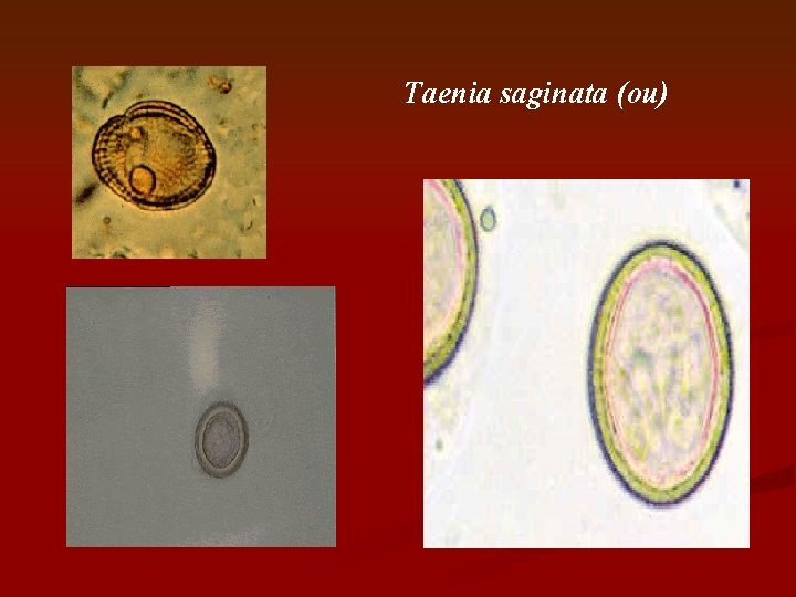 Taenia saginata (ou) 