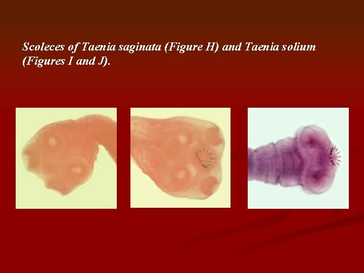 Scoleces of Taenia saginata (Figure H) and Taenia solium (Figures I and J). 