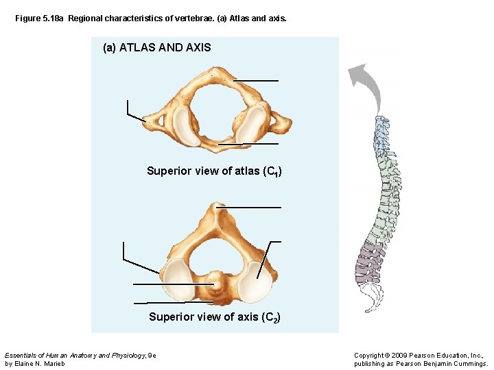 Figure 5. 18 a Regional characteristics of vertebrae. (a) Atlas and axis. (a) ATLAS