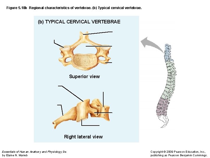 Figure 5. 18 b Regional characteristics of vertebrae. (b) Typical cervical vertebrae. (b) TYPICAL