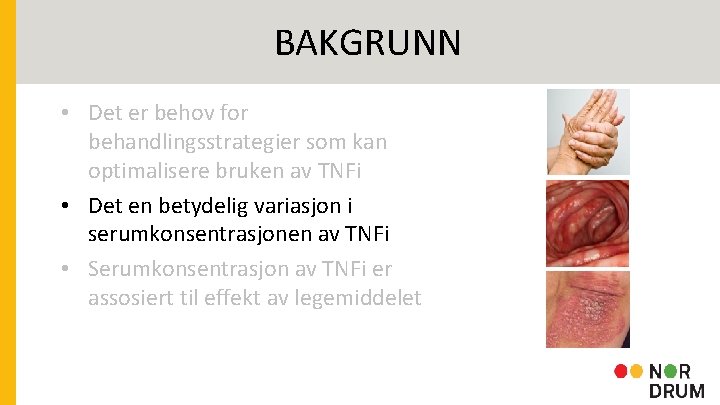 BAKGRUNN • Det er behov for behandlingsstrategier som kan optimalisere bruken av TNFi •