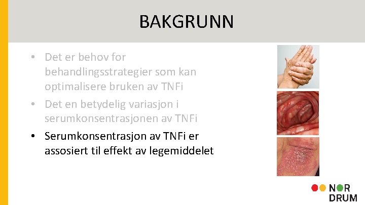 BAKGRUNN • Det er behov for behandlingsstrategier som kan optimalisere bruken av TNFi •
