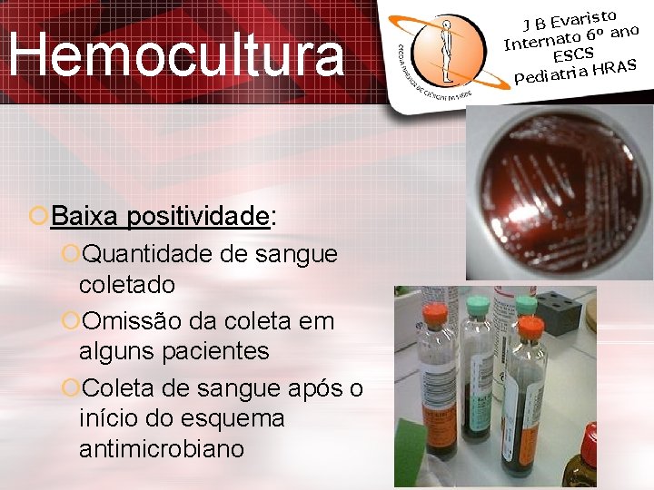 Hemocultura Baixa positividade: Quantidade de sangue coletado Omissão da coleta em alguns pacientes Coleta Hemocultura Baixa positividade: Quantidade de sangue coletado Omissão da coleta em alguns pacientes Coleta