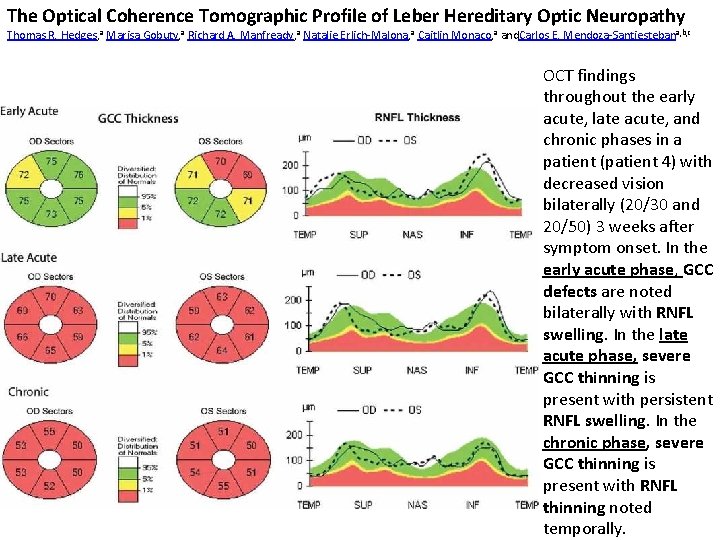 The Optical Coherence Tomographic Profile of Leber Hereditary Optic Neuropathy Thomas R. Hedges, a