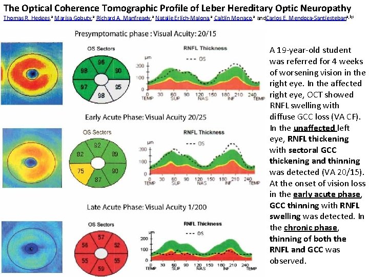 The Optical Coherence Tomographic Profile of Leber Hereditary Optic Neuropathy Thomas R. Hedges, a The Optical Coherence Tomographic Profile of Leber Hereditary Optic Neuropathy Thomas R. Hedges, a