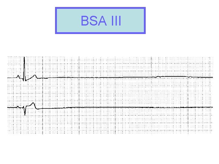 BSA III BSA II 