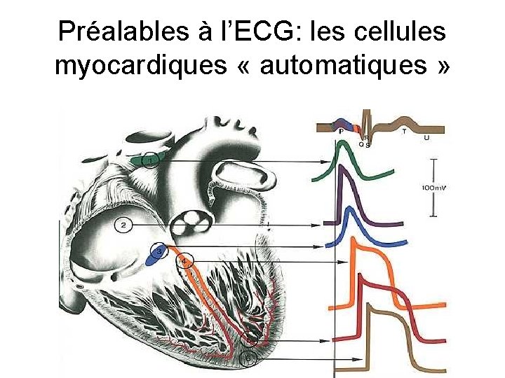 Préalables à l’ECG: les cellules myocardiques « automatiques » 