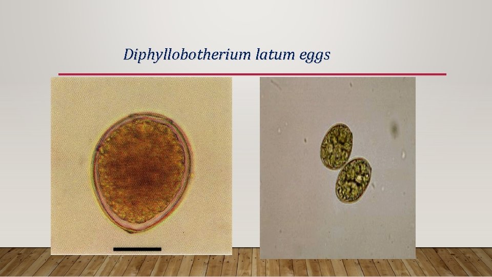 Diphyllobotherium latum eggs 