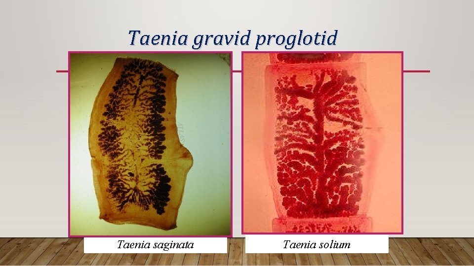 Taenia gravid proglotid Taenia saginata Taenia solium 