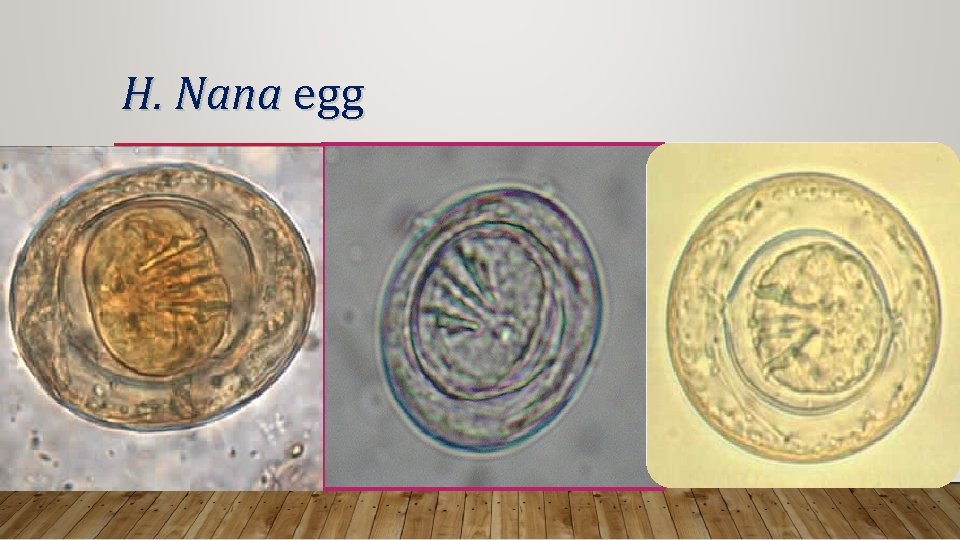 H. Nana egg 