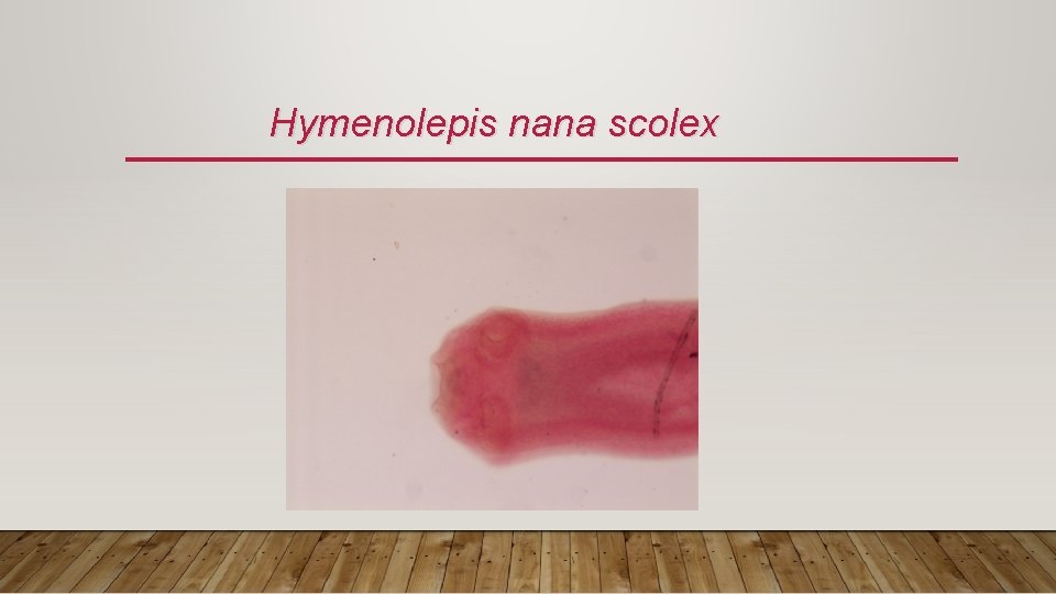 Hymenolepis nana scolex 