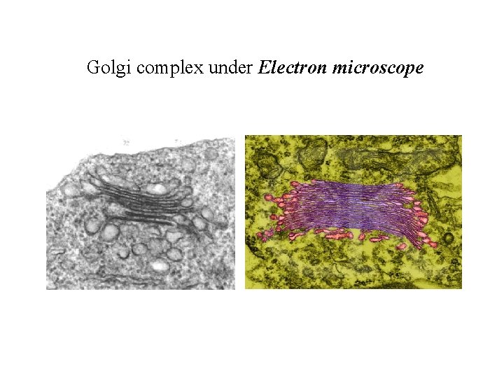 Golgi complex under Electron microscope 
