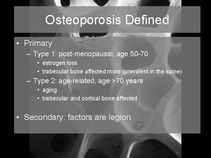 Osteoporosis Defined • Primary – Type 1: post-menopausal, age 50 -70 • estrogen loss