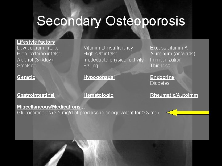 Secondary Osteoporosis Lifestyle factors Low calcium intake High caffeine intake Alcohol (3+/day) Smoking Vitamin