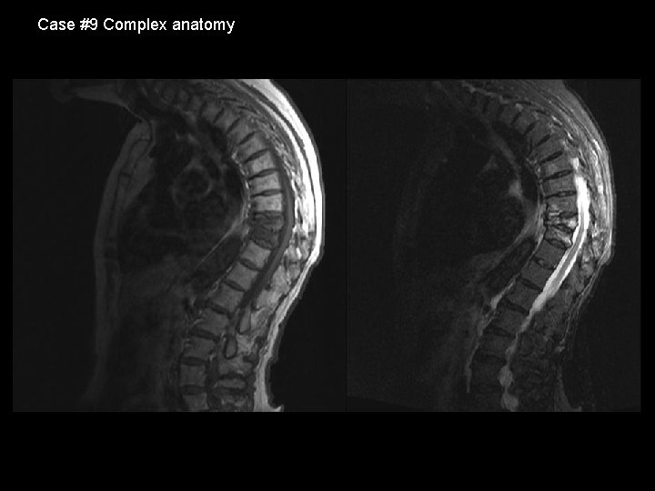 Case #9 Complex anatomy 