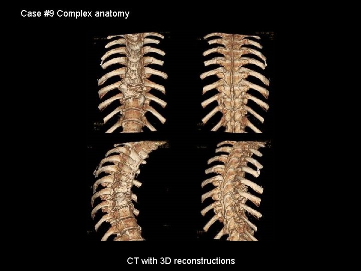 Case #9 Complex anatomy CT with 3 D reconstructions 