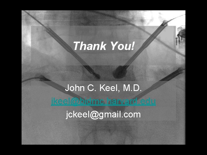 Thank You! John C. Keel, M. D. jkeel@bidmc. harvard. edu jckeel@gmail. com 
